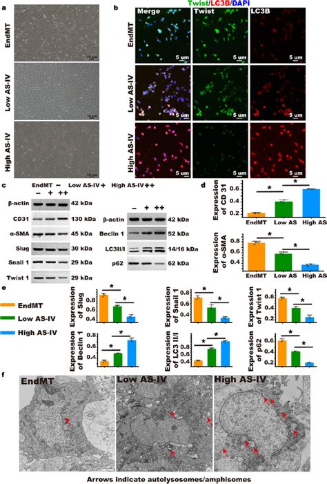 enrdmt|EndMT: A promising and controversial field .